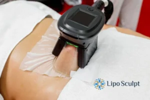 Does Fat Freezing At Home Work? 3 Fat freezing at home from Lipo Sculpt Bury St Edmunds